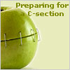 Preparing for a C-section